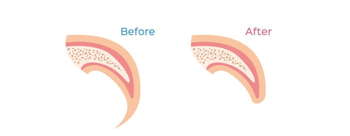 drawing of dog nail before and after clipping